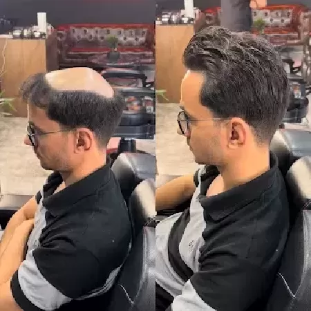 پروتزمو داتاماس