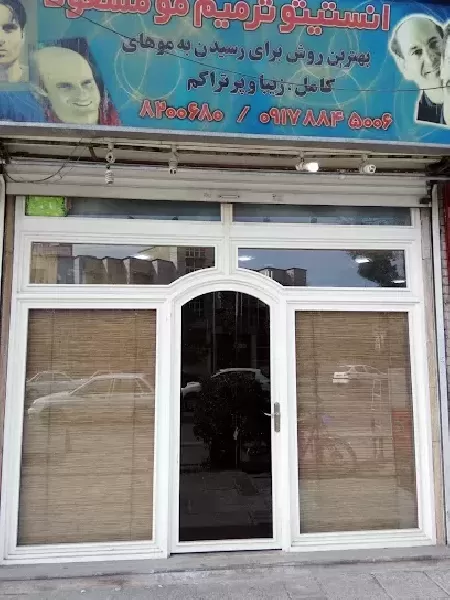 پروتز مو و چسب پروتز شيراز مسعود