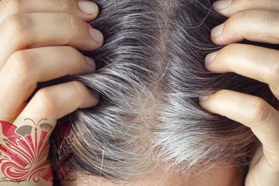 چرا موهايمان سفيد ميشوند و چگونه ميتوان روند پير شدن آنها را کند کرد؟