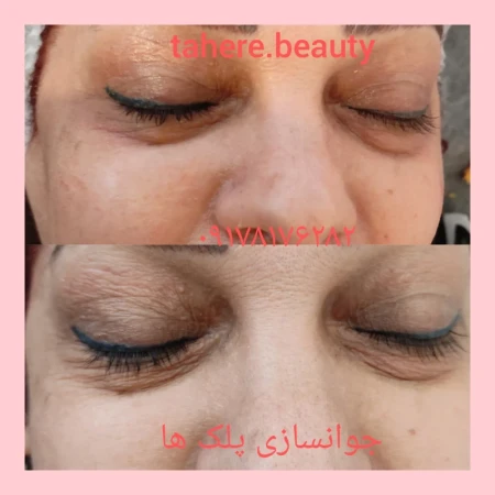 فيشال تخصصي طاهره بيوتي